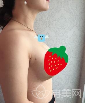 山东省立医院整形科价位表暑期全新版强势来袭,附************案例