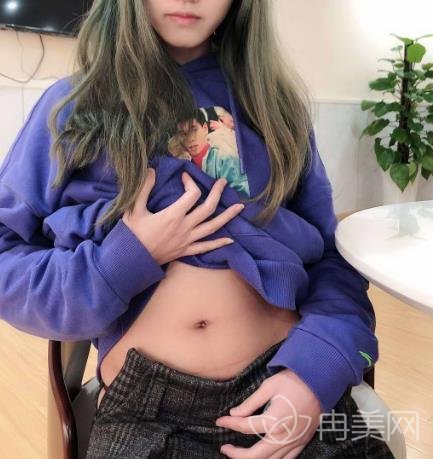 中国人民解放军海军总医院祛疤,重新给了新妈妈自信