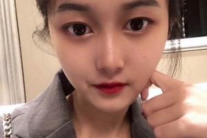 广州中山三院整形科？下颌角案例介绍+医生推荐