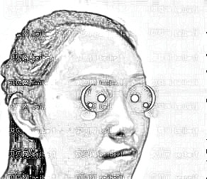 西安雁塔华旗唯美门诊部张沙沙假体隆鼻介绍片较新分享_鼻整形后说不满意那是不可能的,哈哈。