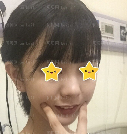 西京医院整形科张曦唇部整形介绍片较新分享_如今的嘴唇,看起来性感很多了哦