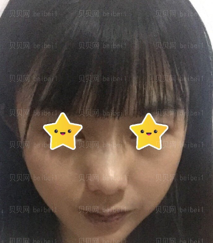 西京医院整形科张曦唇部整形介绍片较新分享_如今的嘴唇,看起来性感很多了哦