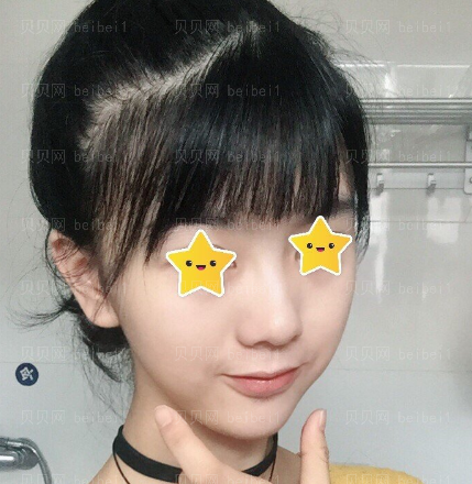 西京医院整形科张曦唇部整形介绍片较新分享_如今的嘴唇,看起来性感很多了哦