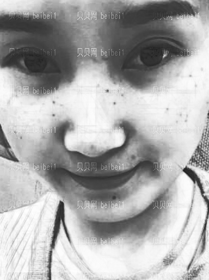 西京医院整形科樊星光子嫩肤介绍片较新分享_皮肤都变得白皙、嫩滑了哦!