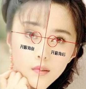 <a href=http://www.girlface.com.cn/price/PC13.html target=_blank class=infotextkey>开眼角</a>手术眼部整形