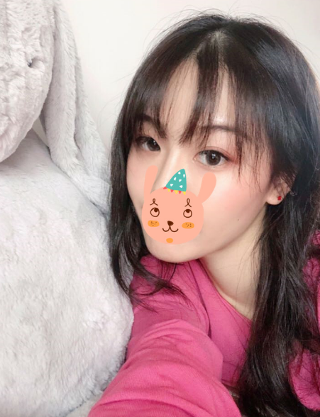 在南京友谊医院做的下颌角切除,*果很好