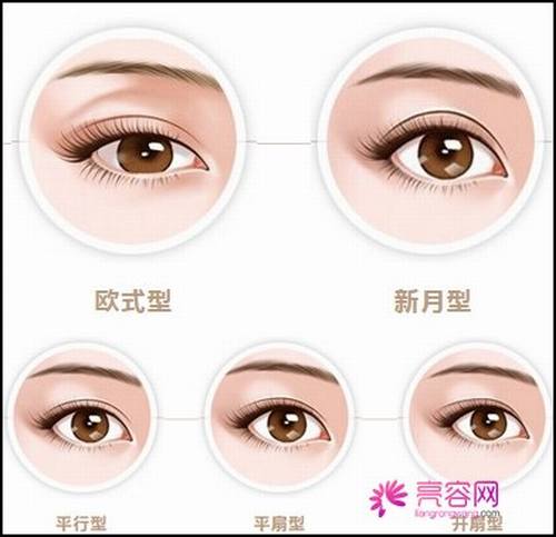 你想做双眼皮吗?埋线双眼皮手术果自然吗?小编给你科普科普埋线双眼皮知识!
