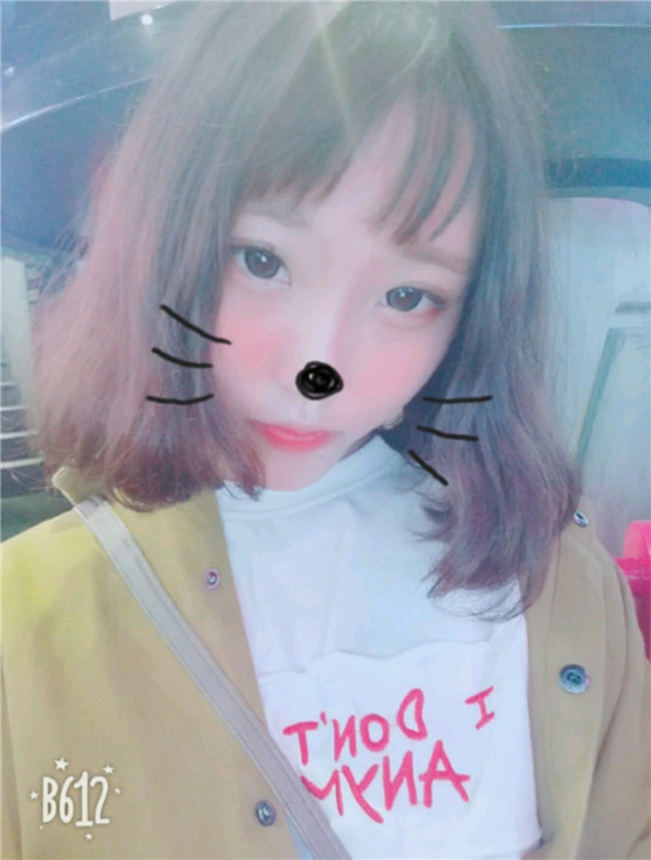 小仙女们,不要做丑女人,要做自己的女神!!双眼皮加苹果肌,一加一等于的果是三哦!速度来围观我的变美案例啦~~~~