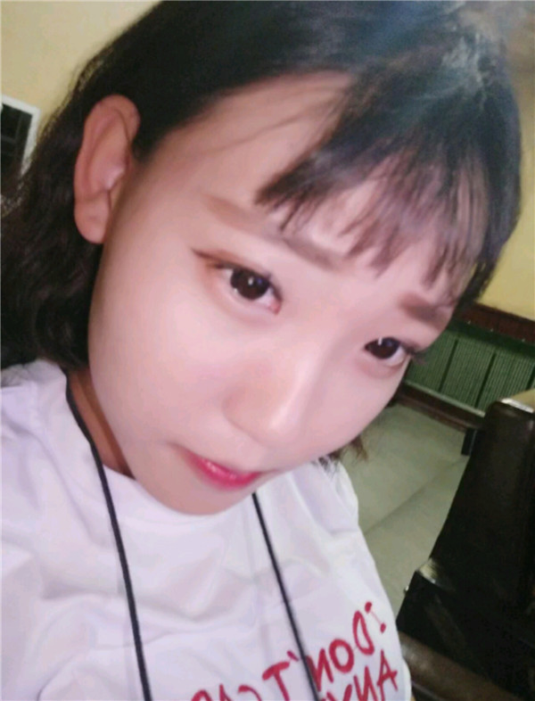 小仙女们,不要做丑女人,要做自己的女神!!双眼皮加苹果肌,一加一等于的果是三哦!速度来围观我的变美案例啦~~~~