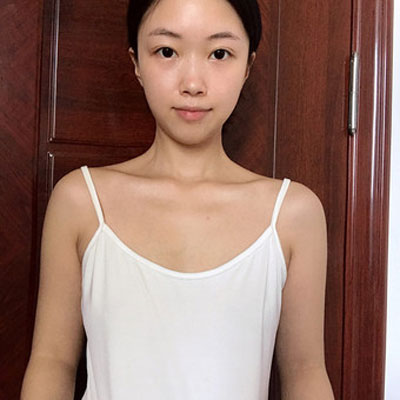 北京艾玛丁小邦丰胸怎么样?案例,价格,口碑