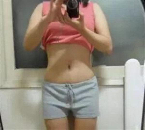 上海韩啸抽脂术后果怎么样?案例,价格,口碑