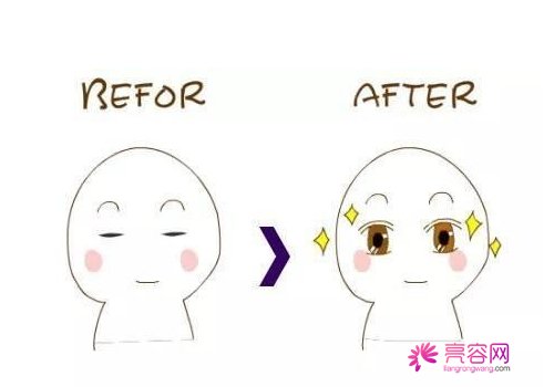 芭比眼是属于哪一种双眼皮啊?常见的双眼皮方法有哪些?