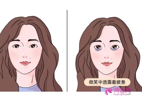 嗨体熊猫真的能去细纹吗?怎样可以让果更理想