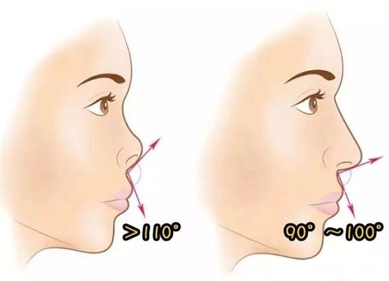 14c645ce71185ed97a6e4be83aa9035f.jpg