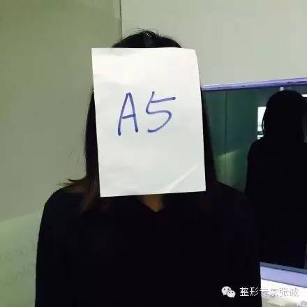 A5脸 A5脸