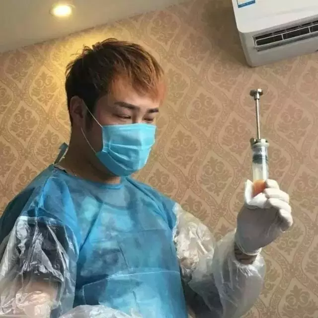 洗头小哥非法行医吸脂手术 洗头小哥非法行医吸脂手术