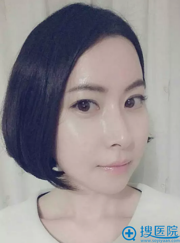 恢复时期照片 恢复时期照片