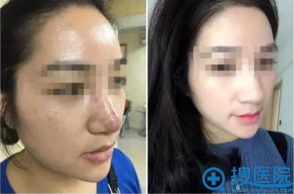 小庄治疗前后对比图 小庄治疗前后对比图