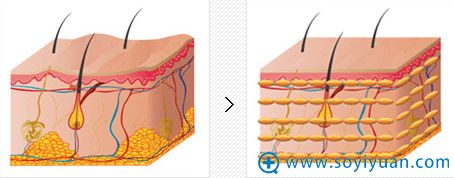20161109621464.png blob.png