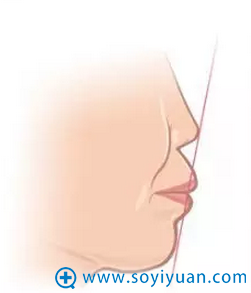 亚洲普遍的鼻子形态 亚洲普遍的鼻子形态