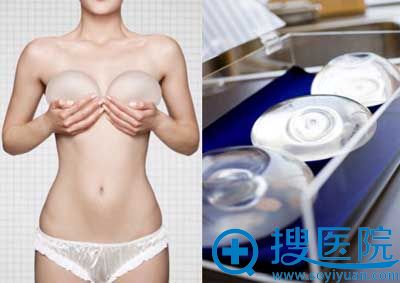 取出隆胸硅胶假体 取出隆胸硅胶假体