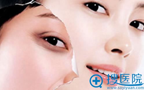 拉皮祛皱 拉皮祛皱