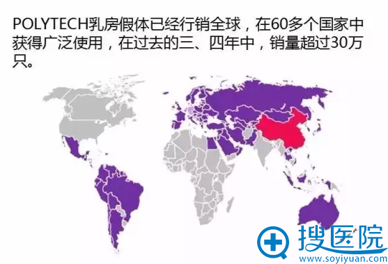 宝俪假体世界销量超30万只 宝俪假体世界销量超30万只