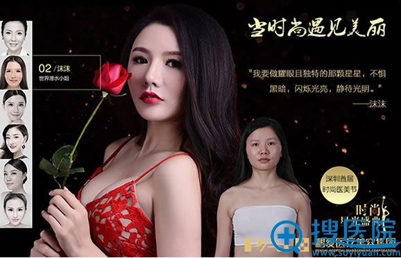 成功变美的爱美者现场走秀 成功变美的爱美者现场走秀