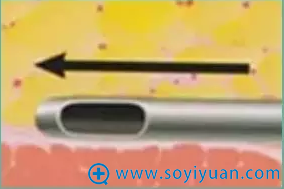 20161116238525.png blob.png