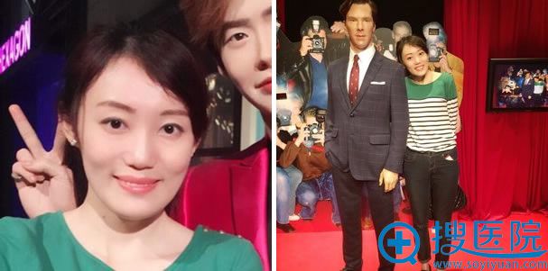 下巴磨骨手术第150天 下巴磨骨手术第150天